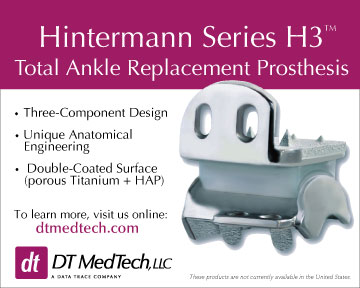 Hintegra Total Ankle Replacement