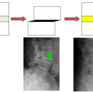 Figure 5-2