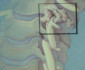 Cervical Nerve Root